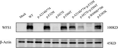 Novel WFS1 variants are associated with different diabetes phenotypes